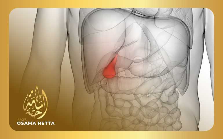 علاج الصفراء الانسدادية بالأشعة التداخلية