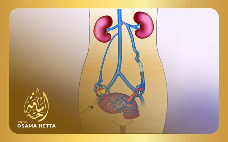 الحوض المحتقن