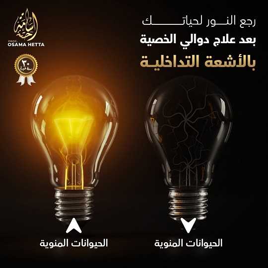 دوالي الخصية
