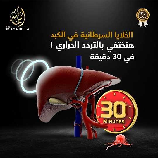 أورام الكبد
