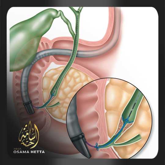 الصفراوية