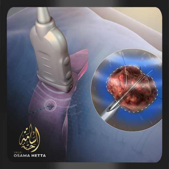 التردد الحراري