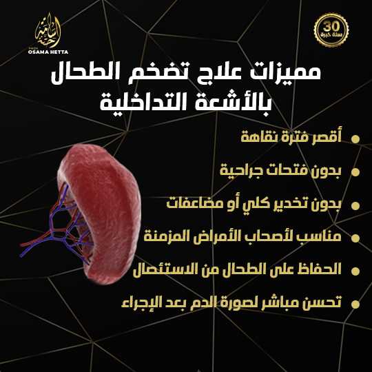 تضخم الطحال