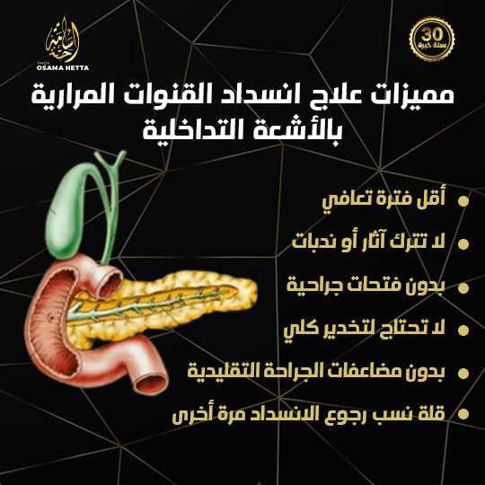 المرارة