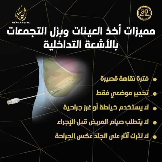 بزل التجمعات