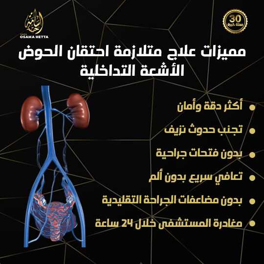 متلازمة احتقان الحوض