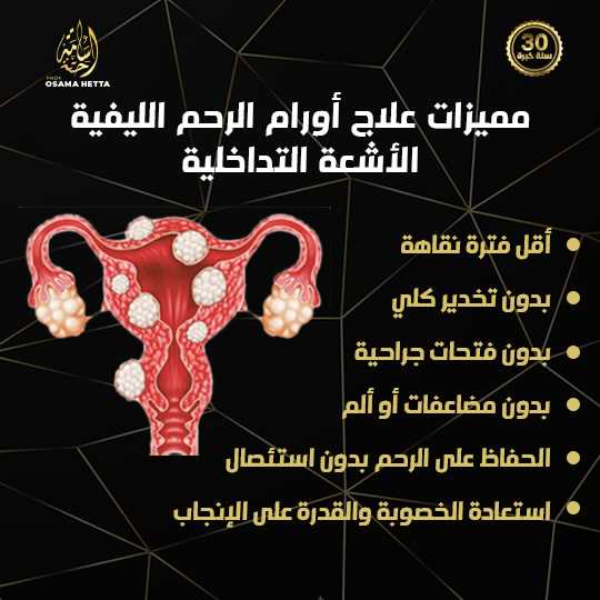 أورام الرحم الليفية