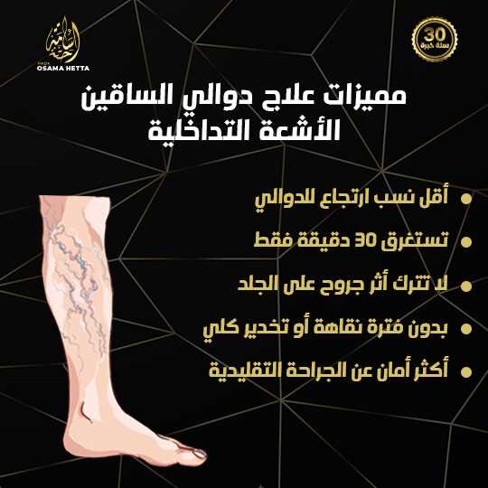 دوالي الساقين