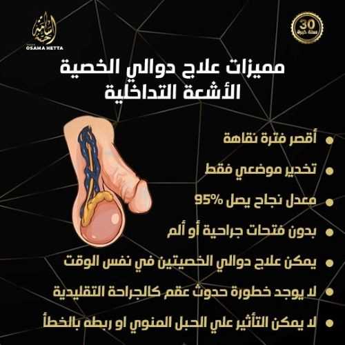 مميزات-علاج-دوالي-الخصية-بالأشعة-التداخلية