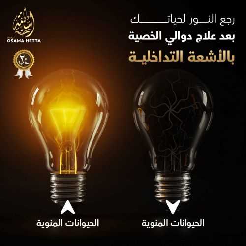 دوالي-الخصية-الحيوانات-المنوية