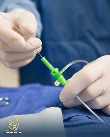 دور الأشعة التداخلية في تركيب الدعامات