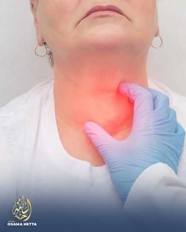 أسباب تضخم الغدة الدرقية